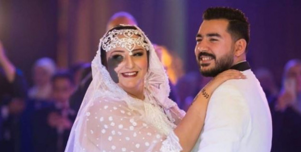 "شروق" تتعرض للتنمر بسبب "وحمة": "فاكرين إن مية نار وقعت على وشي"