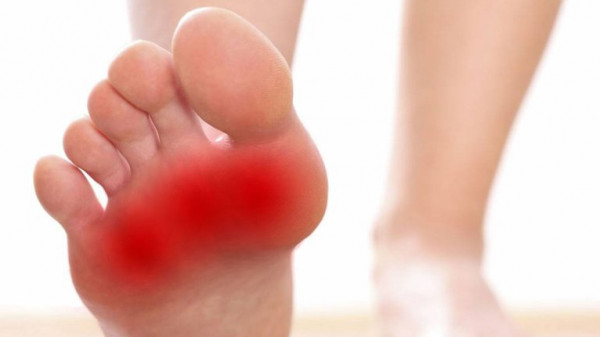 علاجات منزلية تخلصك من مشكلة حرقة الأقدام