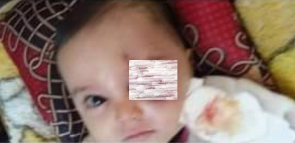 غزة: جاءت الكهرباء في غير معادها.. فخرجت عين الرضيع "آدم" من مكانها
