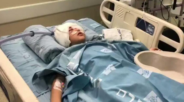 شاهد: لحظة إصابة فتى مقدسي برصاص الاحتلال خلال مواجهات في العيسوية
