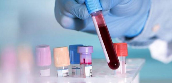 اختبار دم ثوري يكشف 50 نوعاً من السرطان