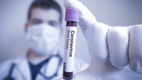 الصحة المصرية تكشف حقيقة انتاج عقار لعلاج فيروس (كورونا)؟
