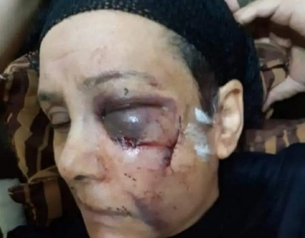 الأم المصرية المعتدي ابنها العاق عليها بالضرب تكشف تفاصيل جديدة