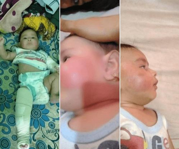 مصري يُعذب طفلته ذات الأربعة أشهر بشكل مُروع