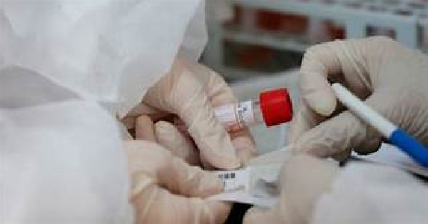 الصحة: وفاة مواطن من نابلس متأثرا بإصابته بفيروس (كورونا)