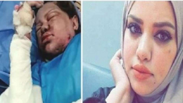 جريمة بشعة.. زوج يحرق زوجته الحامل بالشهر الثامن بالعراق