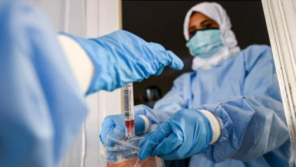 الصحة الاردنية: تسجيل 57 حالة وفاة و3301 إصابة جديدة بفيروس (كورونا)