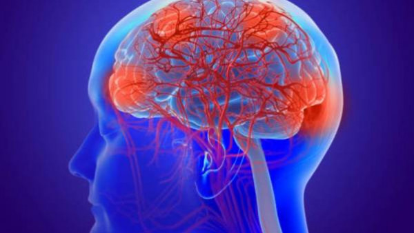 دراسة تكشف معلومات صادمة عن سرطان الدماغ