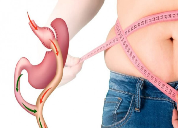 تزايد ملحوظ في اتباع سبل فقدان الوزن كالرجيم والخضوع لعمليات التجميل