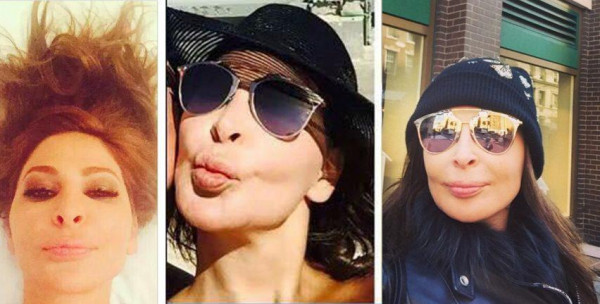 شاهد: فيلر شفايف الفنانات يغيّر من ملامحهنّ