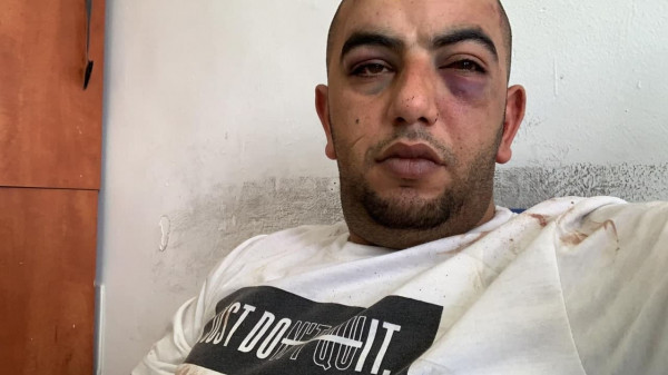 الإفراج عن المقدسي "أحمد فراح" بكفالة مالية وإبعاده 15 يومًا عن حي الشيخ جراح