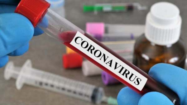 وفاتان و33 إصابة جديدة بفيروس (كورونا) و228 حالة تعافٍ