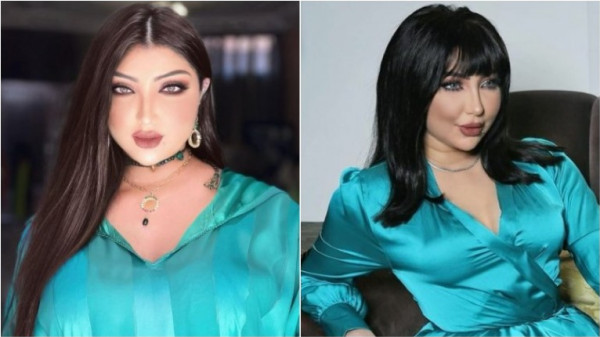 شاهدي:نجمات مع وبدون الغرة