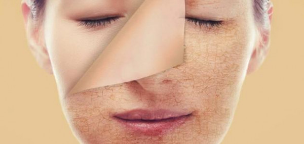 ما هي أعراض جفاف بشرة الوجه؟
