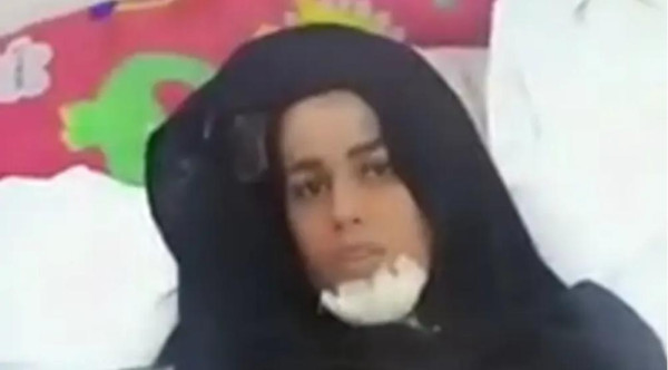 يمني يضرب زوجته بالساطور ويقطع أصابعها