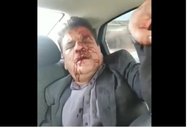 إصابة عضو ثوري بـ "فتح" بجروح بعد دهسه من مستوطن