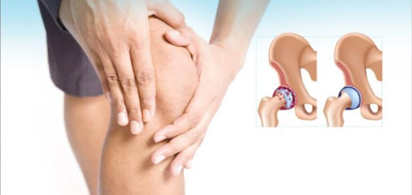 علامات مبكرة لالتهاب المفاصل.. احذر أن تتجاهلها