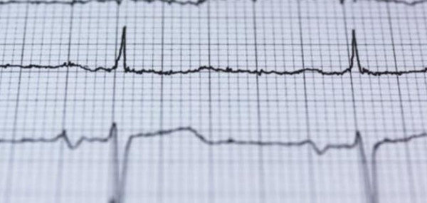 متى تكون سرعة ضربات قلبك مشكلة صحية خطيرة؟