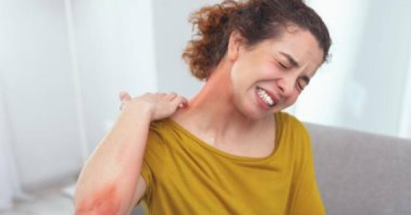 أمل جديد لمرضى الأكزيما المزمنة.. الأجسام المضادة تساعد فى منع الأعراض