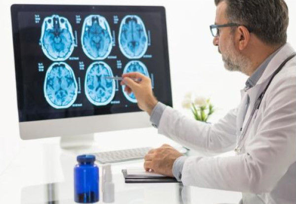 بريطانيا تحارب الجلطات الدماغية بالذكاء الاصطناعي