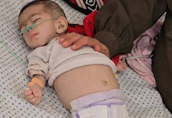 وفاة طفلة في قطاع غزة بسبب المجاعة والجفاف