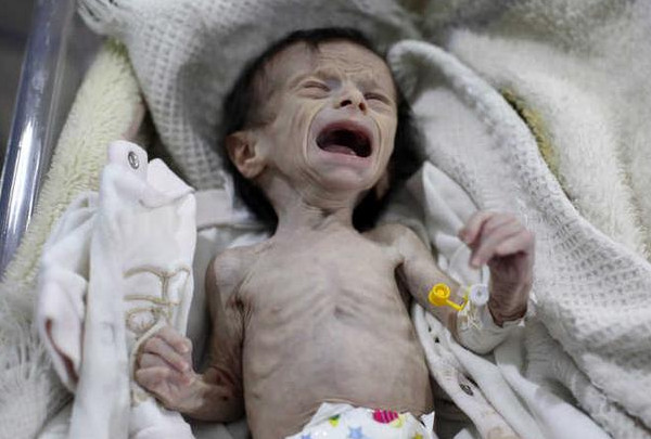 الصحة: الاحتلال يرتكب 8 مجازر بقطاع غزة..ووفاة رضيعين نتيجة الجوع
