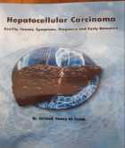 صدور حديثاً كتاب "Hepatocellular Carcinoma" لـ د.سرمد فوزي التايه